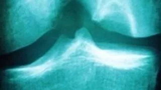 10 modalitati de ati ajuta cainele artritic