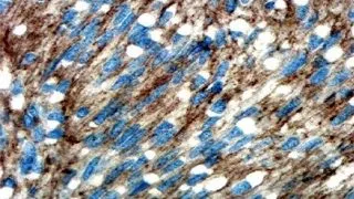 Neoplazia gastrointestinala la pisici